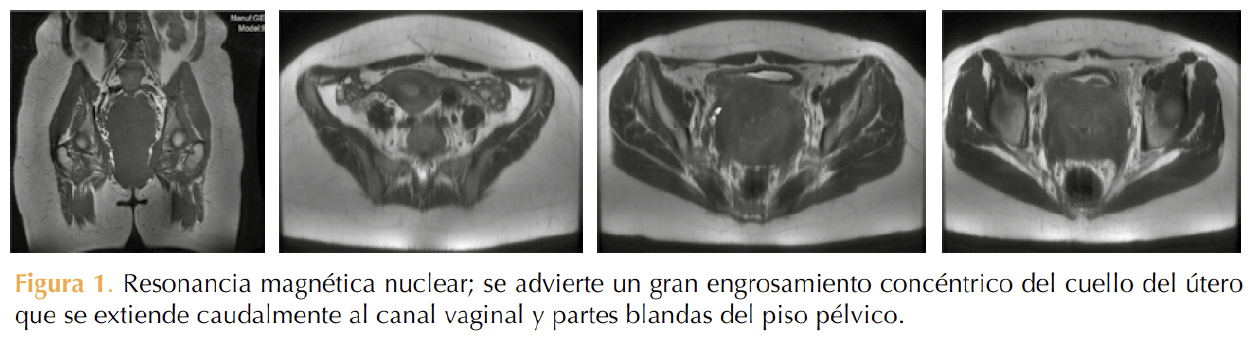 Figura 1
