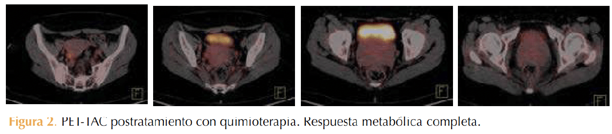 Figura 2