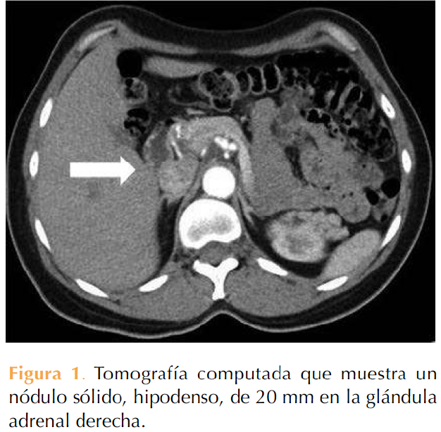 Figura 1
