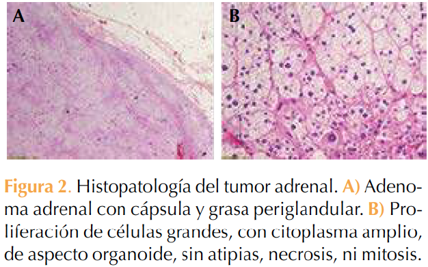 Figura 2