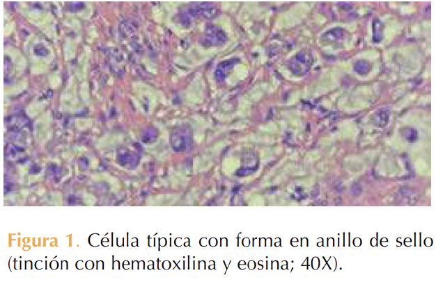 Figura 1