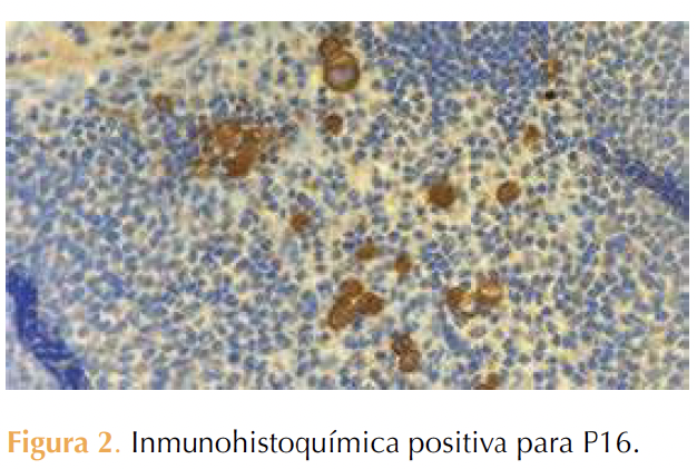 Figura 2