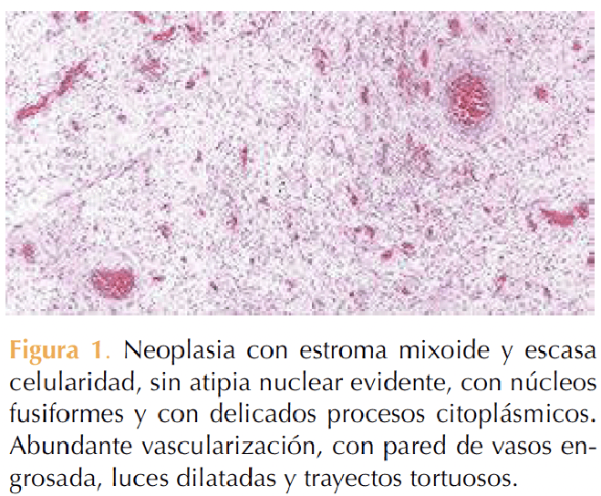 Figura 1