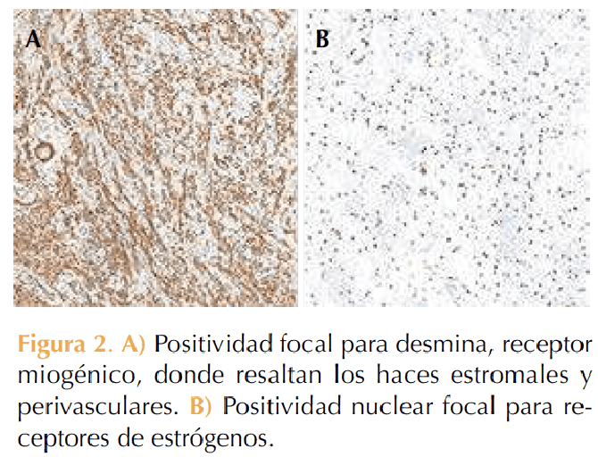 Figura 2