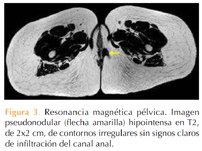 Figura 3
