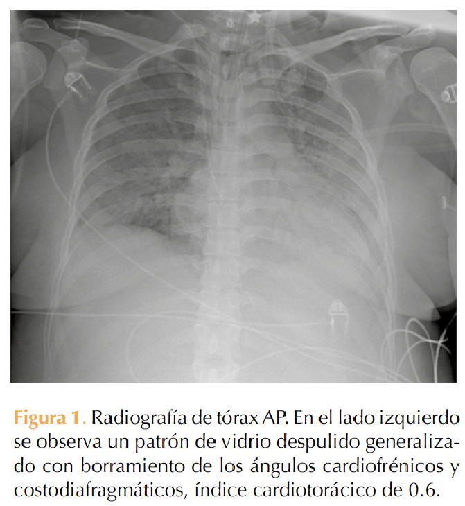 Figura 1