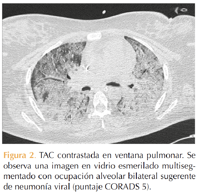 Figura 2
