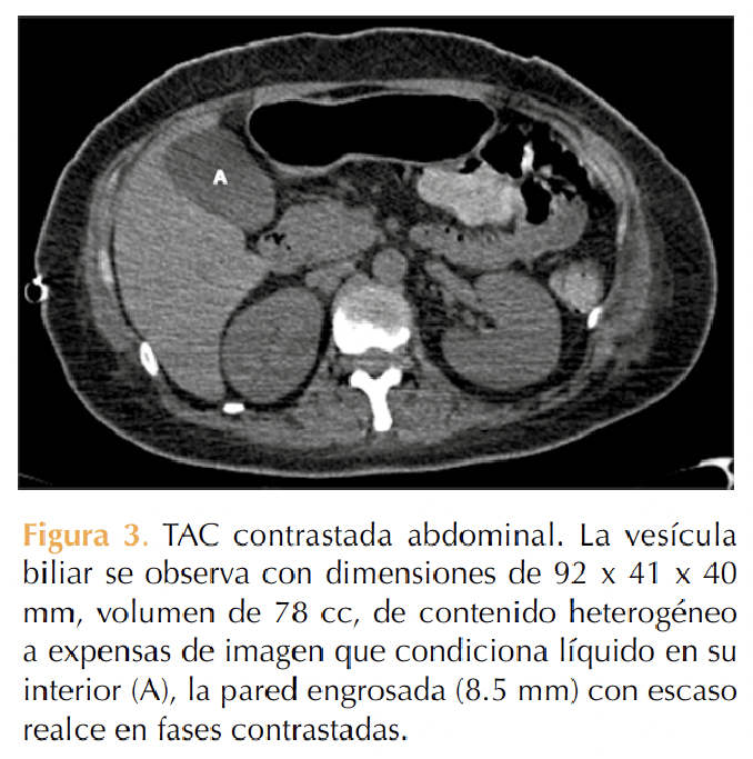 Figura 3