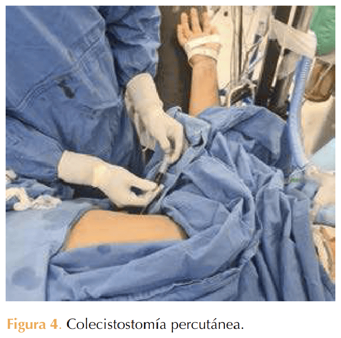 Figura 4