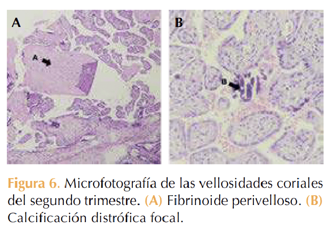 Figura 6