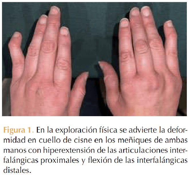 Figura 1