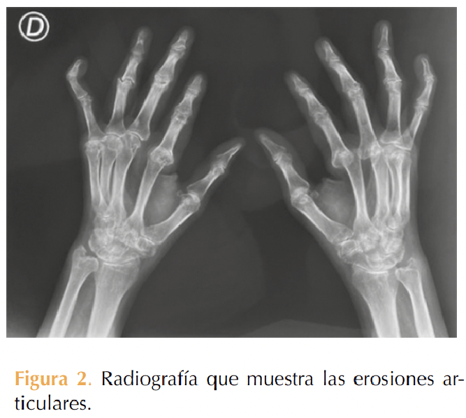 Figura 2